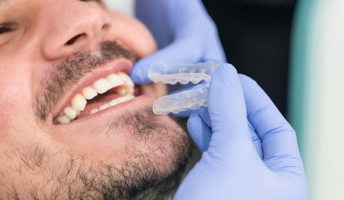 How To Select A Dentist For The Best Dentist For Invisalign