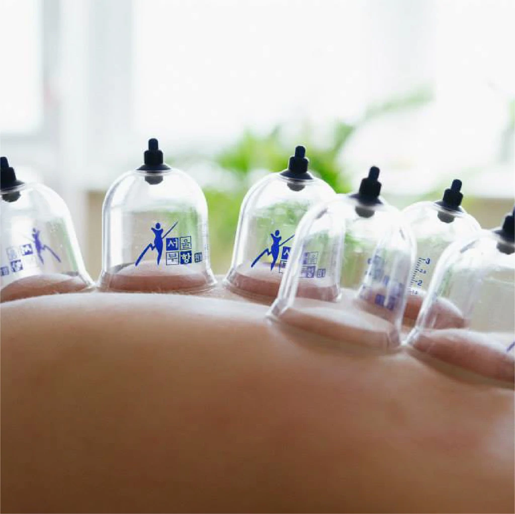 Best Application To Cure Pain Through Body Cupping